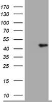 TIA-1 Antibody (clone OTI1C8)