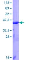 Human IL36A Protein (Recombinant GST)
