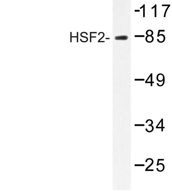 Polyclonal Rabbit anti-Human HSF2 Antibody (Arg432, IHC, WB)