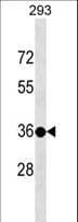 TSPY3 Antibody (aa277-305)