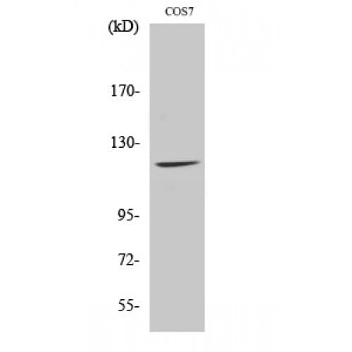 Polyclonal Rabbit anti-Human FUK Antibody (30-110 aa, N-terminal, IF, WB)