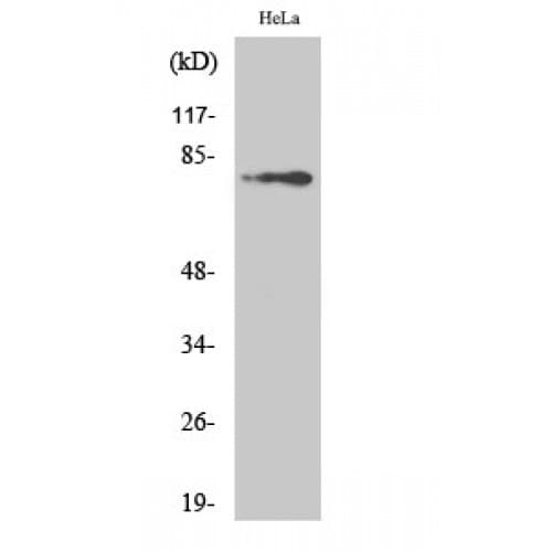 Polyclonal Rabbit anti-Human BTK Antibody (160-240 aa, WB)
