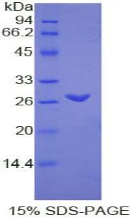 Rat TMEM173 / STING Protein (Recombinant His-T7)