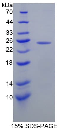 Human MGMT Protein (Recombinant His-T7)