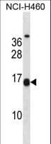 MSGN1 Antibody (aa97-125)
