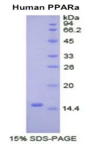 Human PPARA / PPAR Alpha Protein (Recombinant His)