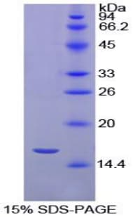 Chicken TTR / Transthyretin Protein (Recombinant His)