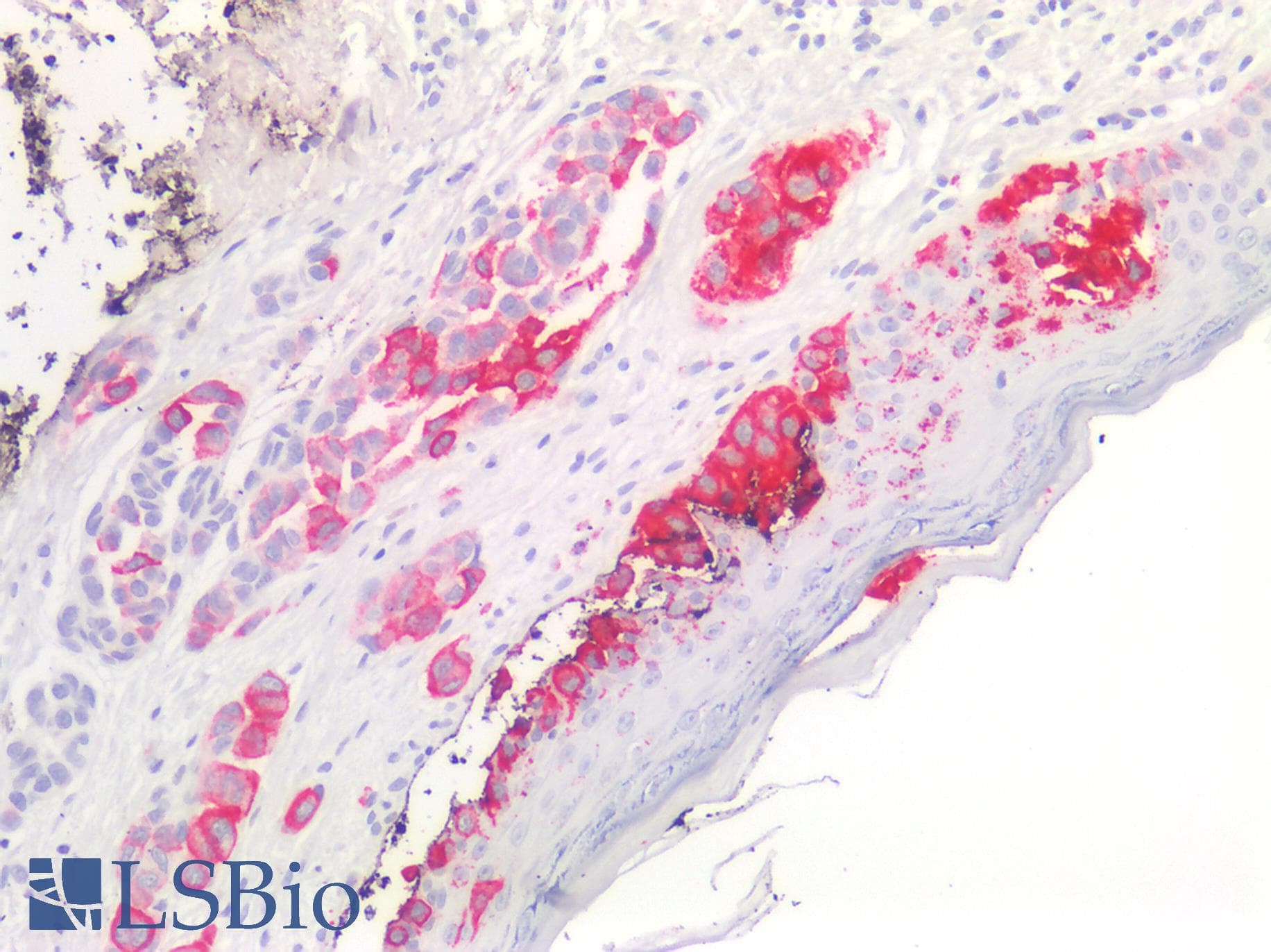 PathPlus™ Melanoma Antibody (clone PNL2, Concentrated)