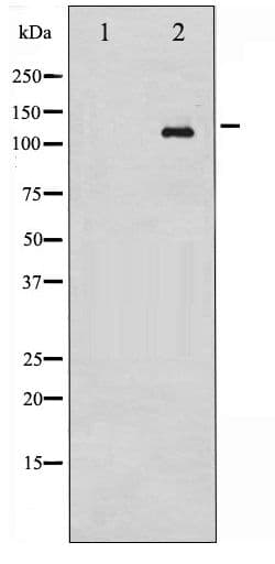 ABL1 / c-ABL Antibody (phospho-Tyr393/412)