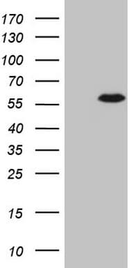 CSNK1G1 / CKI-Gamma 1 Antibody (aa163-422, clone OTI4H3)