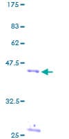 Human RPS17 / Ribosomal Protein S17 (Recombinant GST)