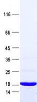 Human CREBL2 Protein (Recombinant His, N-Terminal)