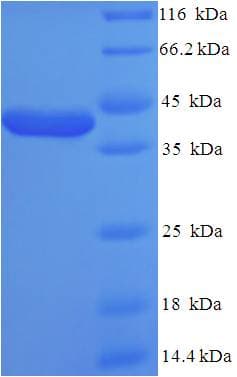 Human KCNJ10 / SESAME / KIR4.1 Protein (Recombinant His-SUMO)