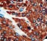 Calponin Antibody (Ready-to-Use)
