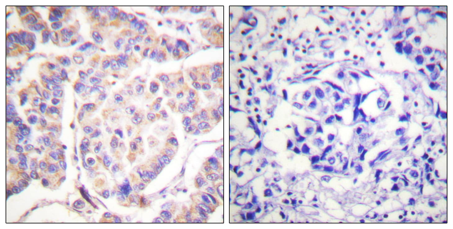 SYK Antibody (aa491-540)