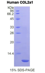 Human COL2A1 / Collagen II Alpha 1 Protein (Recombinant His)