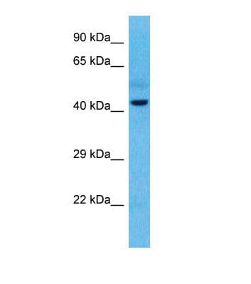 WT1 / Wilms Tumor 1 Antibody (aa39-88)