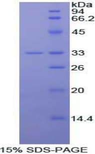 Mouse IL20RA Protein (Recombinant His)