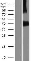 Human ACVR1C / ALK7 Protein (Over-Expression Lysate Myc-DDK (Flag))