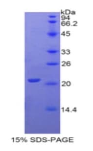 Human GGT1 / GGT Protein (Recombinant His)