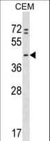 Polyclonal Rabbit anti-Human PRKAR1B Antibody (aa55-84, WB)