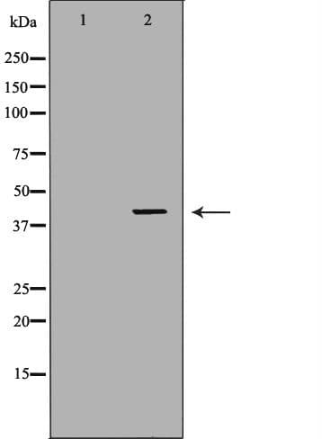 Polyclonal Rabbit anti-Human ABO Glycosyltransferase Antibody (IHC, IF, WB)