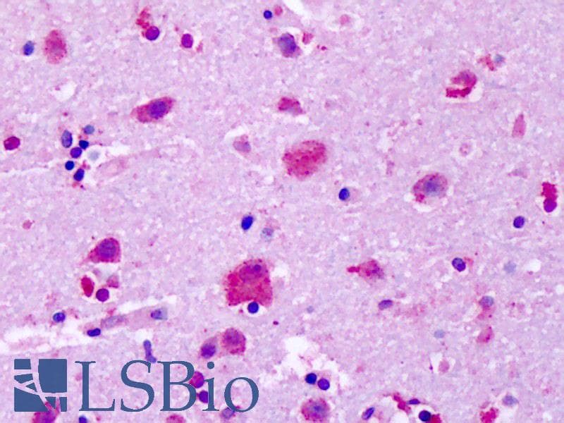 IHC-plus™ Polyclonal Rabbit anti-Human GPR83 Antibody (Extracellular Domain, IHC)