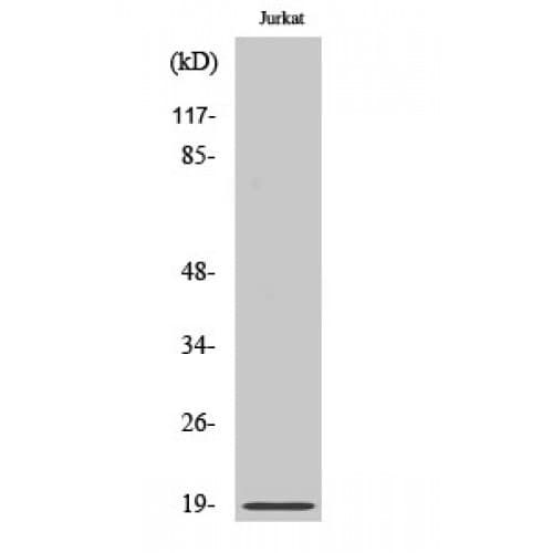 STMN1 / Stathmin / LAG Antibody (1-80 aa)