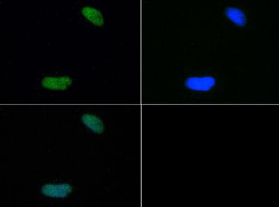 HIST4H4 Antibody (Me2-Lys20)