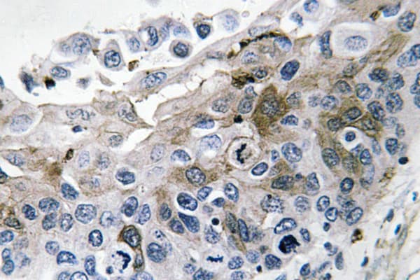 IL-1B / IL-1 Beta Antibody (aa113-162)