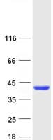 Human UP2 / UPP2 Protein (Recombinant Myc-DDK (Flag))