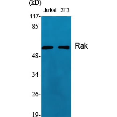 Polyclonal Rabbit anti-Human FRK Antibody (40-120 aa, Internal, IHC, IF, WB)