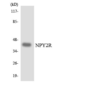 NPY2R Antibody (aa42-91)