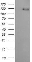 ERBB2 / HER2 Antibody (aa676-1255, clone OTI6G9, Carrier-free)