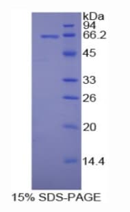 Rat MAP2 Protein (Recombinant His-GST)