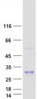 Human MFAP5 / MAGP2 Protein (Recombinant Myc-DDK (Flag))