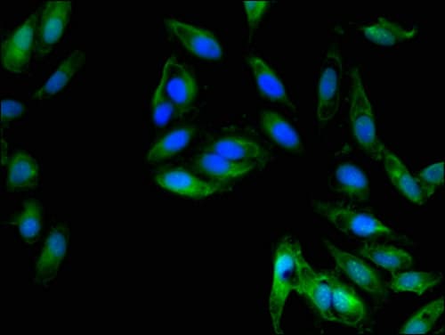 Polyclonal Rabbit anti-Human IL8 / Interleukin 8 Antibody (IF)