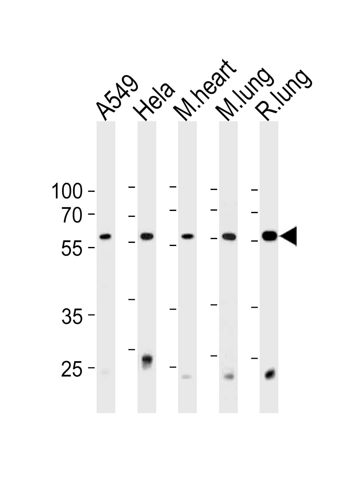 PSMC1 Antibody (aa408-436)