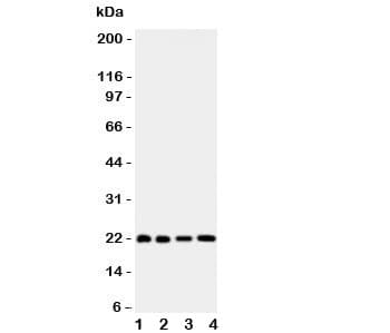 Polyclonal Rabbit anti-Human BID Antibody (aa1-195, IHC, WB)
