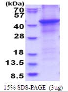 Human HAPLN1 Protein (Recombinant His)