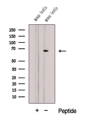 CTP Synthetase 2 / CTPS2 Antibody