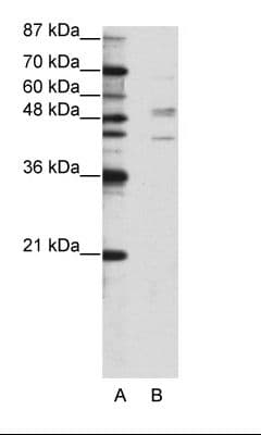 SMAD2 Antibody (N-Terminus)
