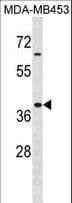HOXA9 Antibody (aa160-189)