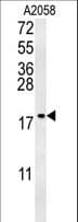 GM2A Antibody (aa25-54)