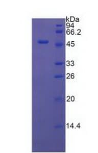 Rat CD46 Protein (Recombinant His-GST)