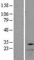 Thymidylate Kinase Protein (Over-Expression Lysate Myc-DDK (Flag))