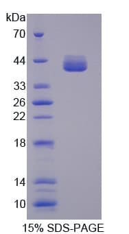 Human ALDOB Protein (Recombinant His-T7)