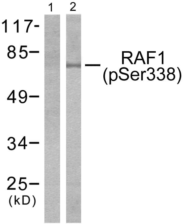 RAF1 / RAF Antibody (phospho-Ser338)