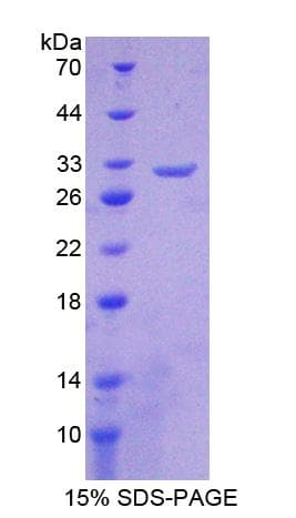 Human CHRNB2 Protein (Recombinant His-T7)