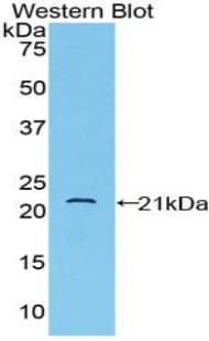 CD8B / CD8 Beta Antibody (aa22-175)